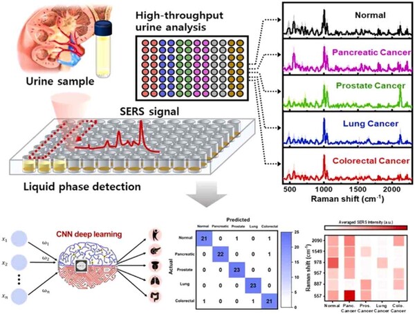 소변을 이용한 췌장암, 전립선암, 폐암, 대장암 동시 진단 기술