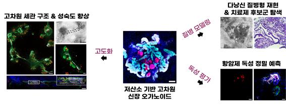 저산소 기반 고차원 신장 오가노이드의 생물학적 특성 및 맞춤형 정밀 의료 응용 가능성