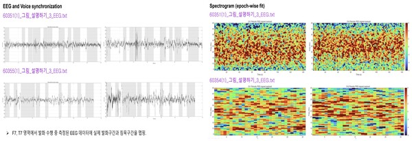 웨어러블 기기를 통해 수집된 발화 및 뇌파 데이터