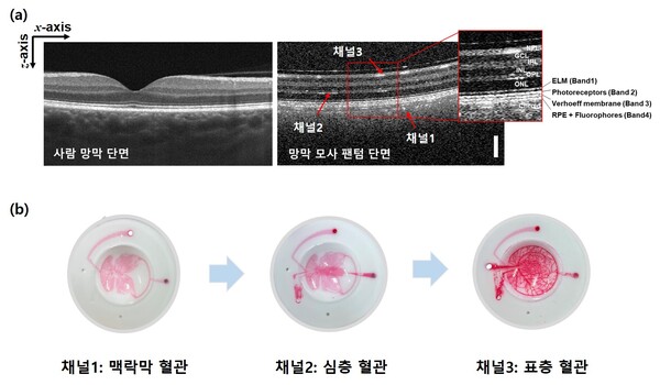 KRISS가 개발한 망막 모사 안구 팬텀의 구조