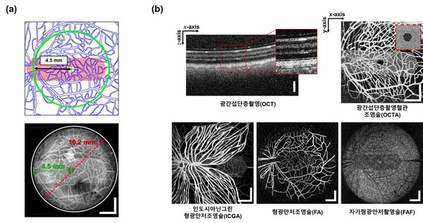 망막 모사 안구 팬텀을 이용한 망막 진단 장비 성능 평가 결과